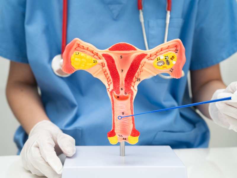 ấm tử cung .3 cấp độ dưỡng buồng trứng