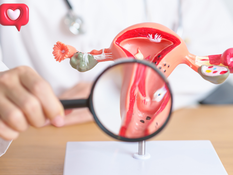 Đa nang buồng trứng  là tình trạng rối loạn nội tiết tố khiến buồng trứng của người phụ nữ xuất hiện nhiều nang nhỏ.