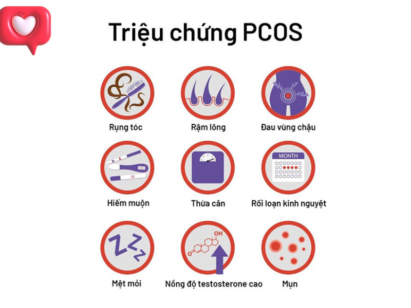 Những dấu hiệu phổ biến của buồng trứng đa nang.