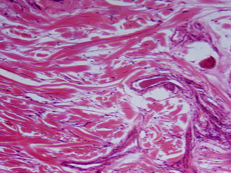 Dưỡng buồng trứng