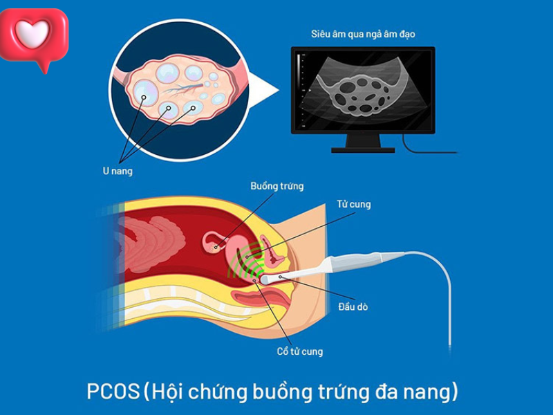 Phòng ngừa từ sớm là cách bảo vệ sức khỏe của bản thân.