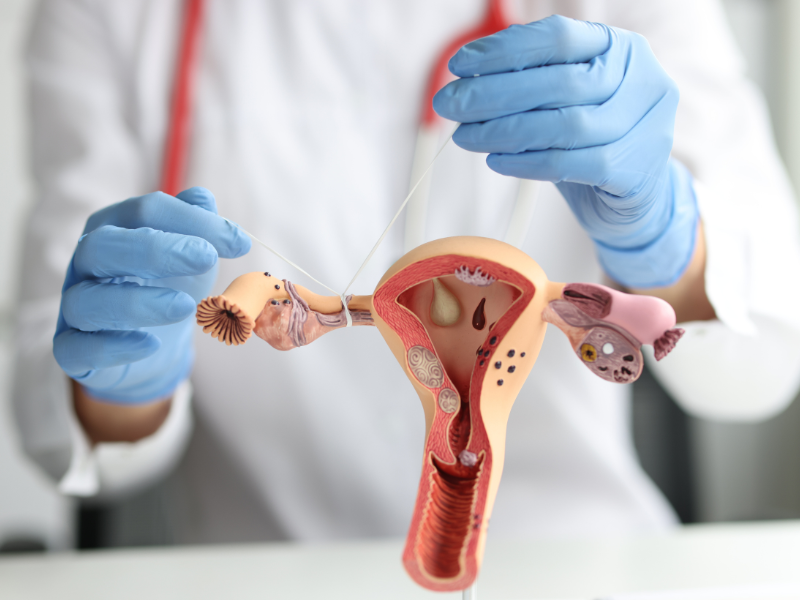 Tăng nhu động vòi trứng