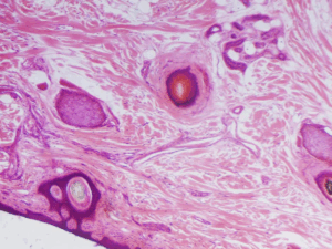 TRứng khỏe, thả dễ đậu